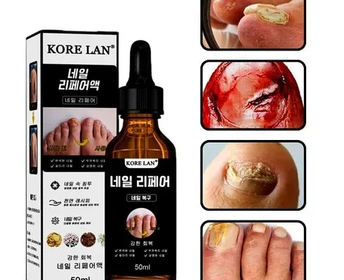 맘카페에서 난리난 큐로힐토네일 추천 아이템 Top 8 순위표